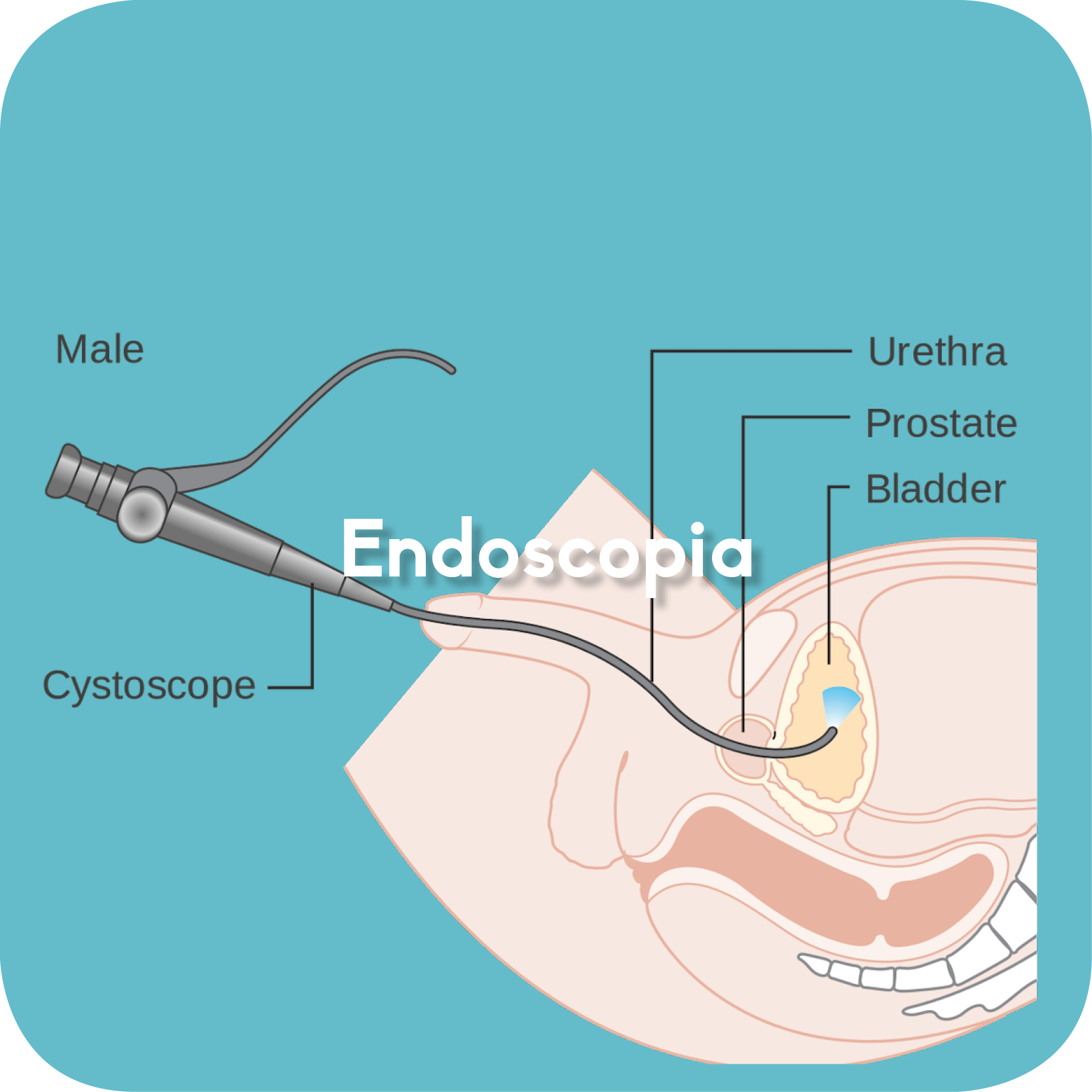endoscopia1